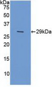 Polyclonal Antibody to Xeroderma Pigmentosum, Complementation Group G (XPG)