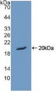Polyclonal Antibody to High Mobility Group Nucleosome Binding Domain Protein 1 (HMGN1)