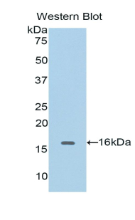 Polyclonal Antibody to Cyclin Dependent Kinase 1 (CDK1)
