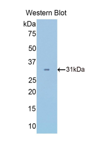 Polyclonal Antibody to Pyruvate Dehydrogenase Beta (PDHb)
