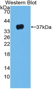 Polyclonal Antibody to Leucine Rich Alpha-2-Glycoprotein 1 (LRG1)