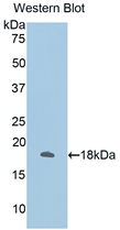 Polyclonal Antibody to Annexin A2 (ANXA2)