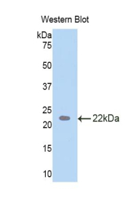 Polyclonal Antibody to Tar DNA Binding Protein 43kDa (TDP43)