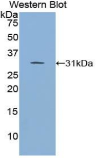 Polyclonal Antibody to Inhibitor Of Nuclear Factor Kappa B Kinase Interacting Protein (IKBIP)