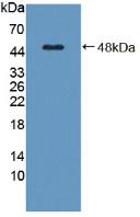 Polyclonal Antibody to Complement Component 8g (C8g)