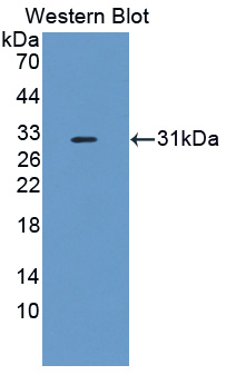 Polyclonal Antibody to Complement Factor I (CFI)