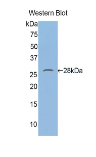 Polyclonal Antibody to Toll Like Receptor 1 (TLR1)