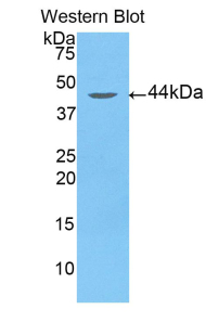 Polyclonal Antibody to Arrestin Beta 2 (ARRb2)