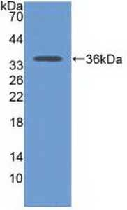 Polyclonal Antibody to Cadherin 17 (CDH17)