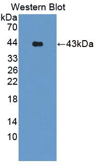 Polyclonal Antibody to S100 Calcium Binding Protein A2 (S100A2)