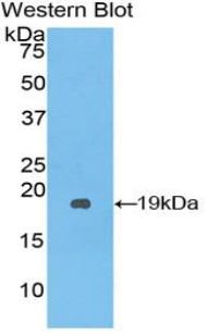 Polyclonal Antibody to Serpin A10 (SERPINA10)
