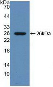 Polyclonal Antibody to Serpin A10 (SERPINA10)