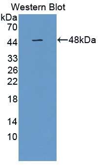 Polyclonal Antibody to Platelet Activating Factor Acetylhydrolase 2 (PAFAH2)