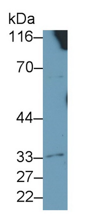 Polyclonal Antibody to Interleukin 4 Receptor (IL4R)