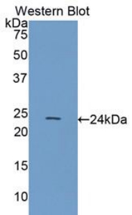 Polyclonal Antibody to Heat Shock Protein Beta 8 (HSPb8)