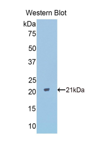 Polyclonal Antibody to Peroxisome Proliferator Activated Receptor Delta (PPARd)