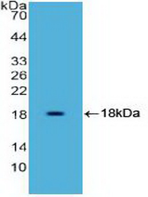 Polyclonal Antibody to High Mobility Group AT Hook Protein 1 (HMGA1)