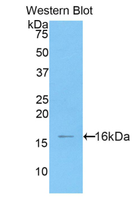 Polyclonal Antibody to High Mobility Group AT Hook Protein 2 (HMGA2)