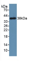 Polyclonal Antibody to Platelet Derived Growth Factor Receptor Beta (PDGFRb)