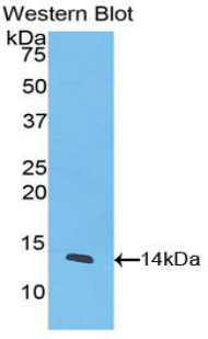 Polyclonal Antibody to Interferon Inducible T-Cell Alpha Chemoattractant (ITaC)