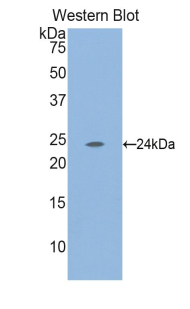 Polyclonal Antibody to Laminin Alpha 2 (LAMa2)