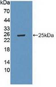 Polyclonal Antibody to Laminin Alpha 4 (LAMa4)