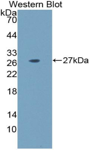 Polyclonal Antibody to Laminin Alpha 5 (LAMa5)