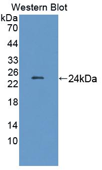 Polyclonal Antibody to Laminin Beta 2 (LAMb2)