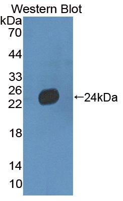 Polyclonal Antibody to Laminin Beta 3 (LAMb3)