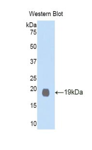 Polyclonal Antibody to Growth Differentiation Factor 1 (GDF1)