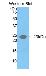 Polyclonal Antibody to Growth Differentiation Factor 3 (GDF3)