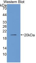 Polyclonal Antibody to Collagen Type VIII Alpha 1 (COL8a1)