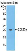 Polyclonal Antibody to Collagen Type VIII Alpha 1 (COL8a1)