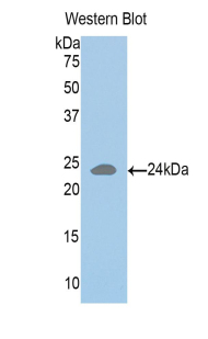 Polyclonal Antibody to HLA Class II Histocompatibility Antigen, DR Alpha Chain (HLA-DRA)