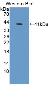 Polyclonal Antibody to Poly A Specific Ribonuclease (PARN)