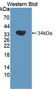 Polyclonal Antibody to Adrenergic Receptor Beta Kinase 2 (ADRbK2)