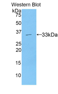 Polyclonal Antibody to Axis Inhibition Protein 2 (AXIN2)