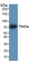 Polyclonal Antibody to A Kinase Anchor Protein 11 (AKAP11)