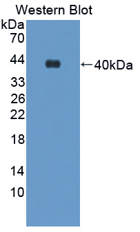 Polyclonal Antibody to Aminolevulinate Delta Dehydratase (ALAD)
