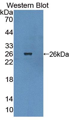 Polyclonal Antibody to Breakpoint Cluster Region (BCR)