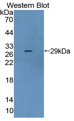 Polyclonal Antibody to Breakpoint Cluster Region (BCR)