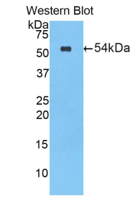 Polyclonal Antibody to Lipase, Bile Salt Dependent (BSDL)