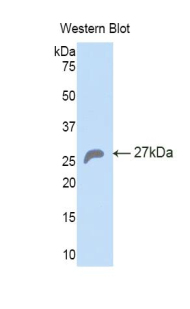Polyclonal Antibody to Heat Shock 70kDa Protein 5 (HSPA5)