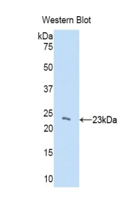 Polyclonal Antibody to Chromobox Homolog 3 (CBX3)