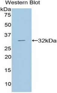 Polyclonal Antibody to Diacylglycerol Kinase Alpha (DGKa)