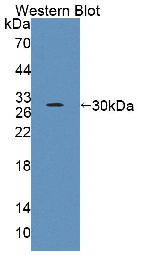 Polyclonal Antibody to Dyskerin (DKC)
