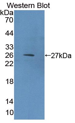 Polyclonal Antibody to Eukaryotic translation initiation factor 2D (EIF2D)