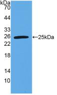 Polyclonal Antibody to TNF Like Ligand 1A (TL1A)