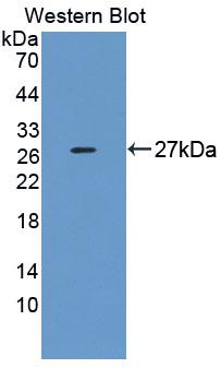 Polyclonal Antibody to Zuotin Related Factor 1 (ZRF1)