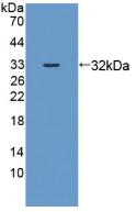 Polyclonal Antibody to Zuotin Related Factor 1 (ZRF1)